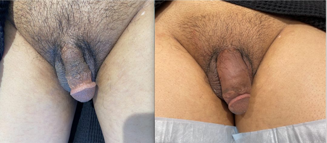 16-6of6-1080x474