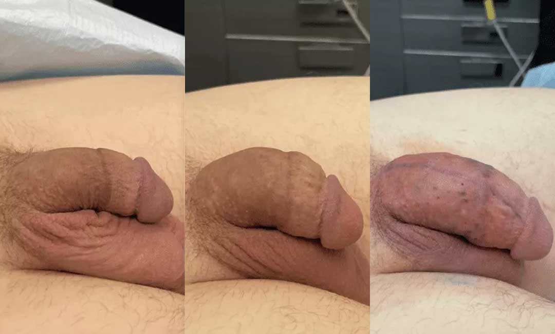252522-4