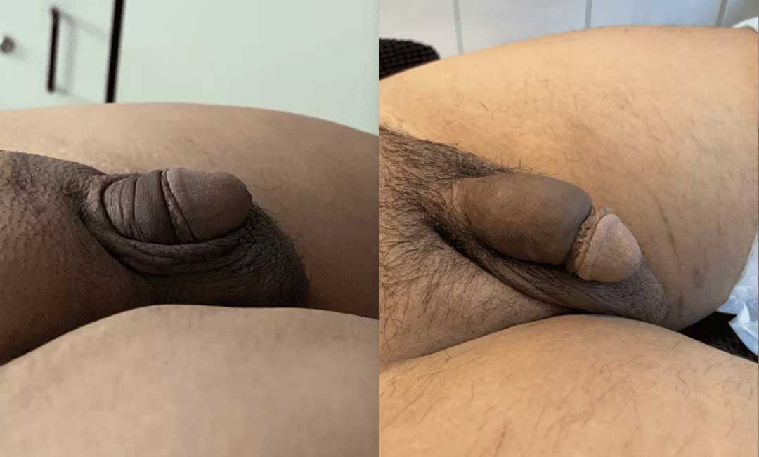 252585-5