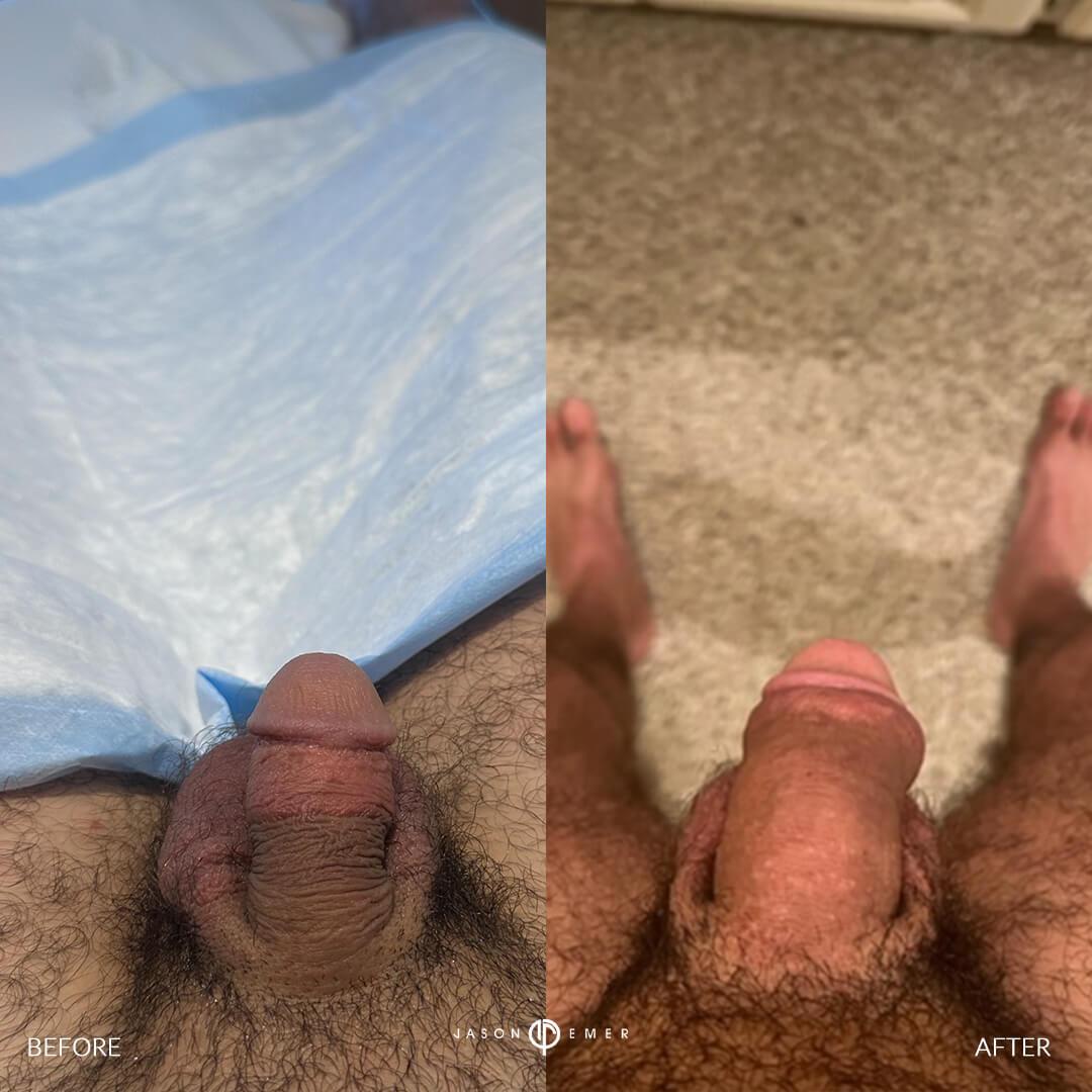 BA w_ Front up selfie