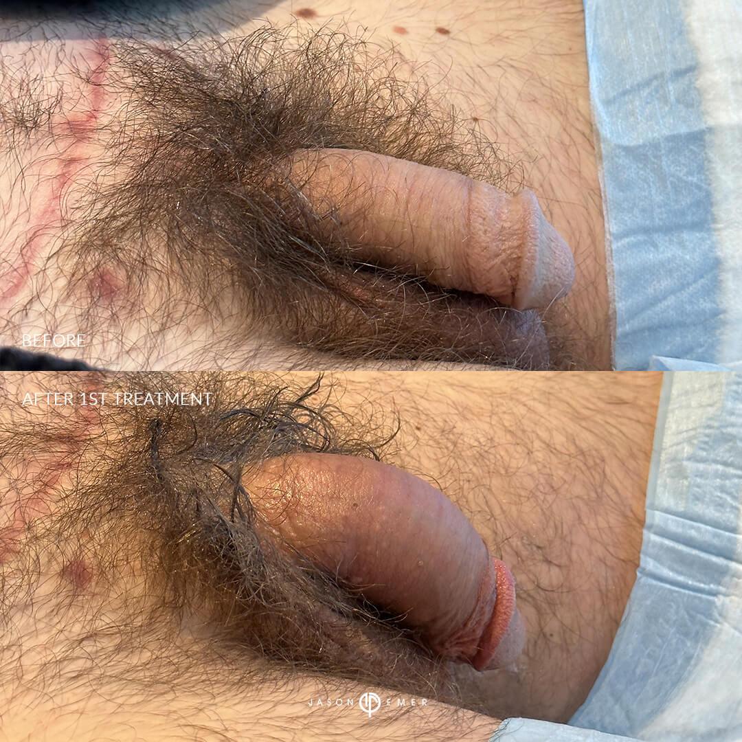 ba1st treat right2222