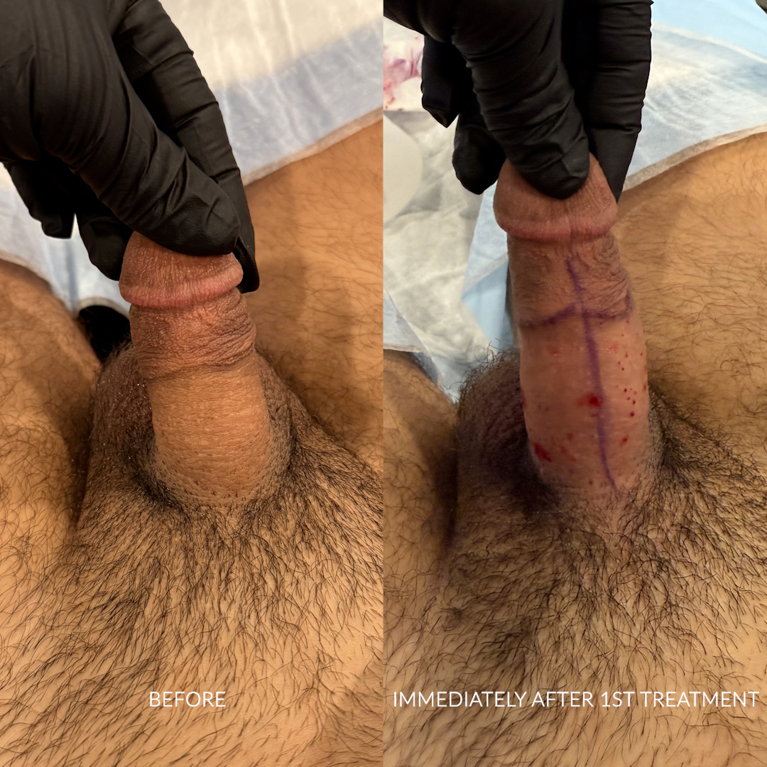 CP_BA_02