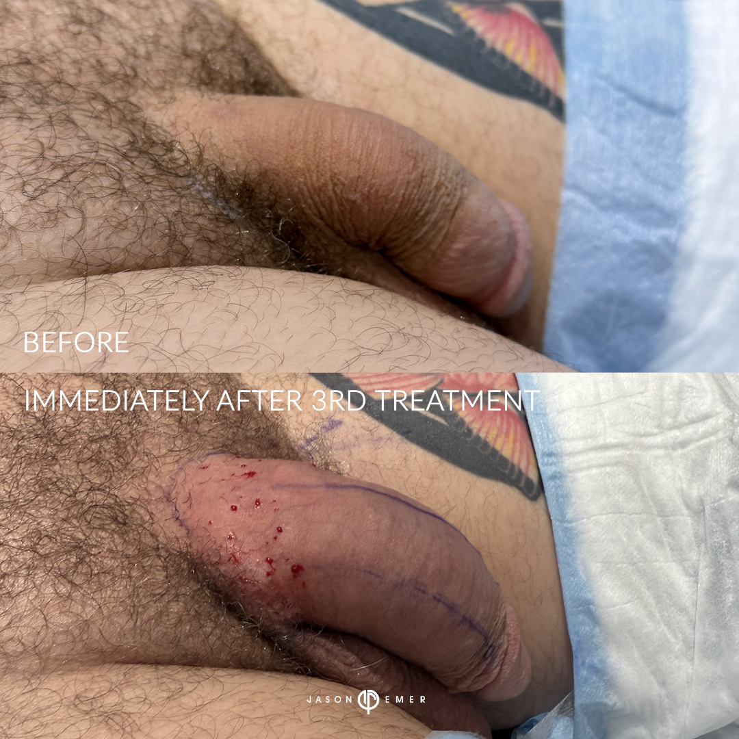 CP_BA_3_03