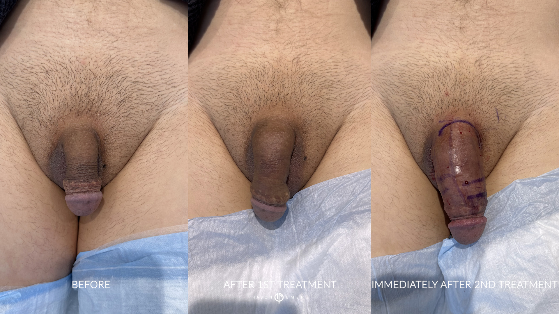 JP_BA_05