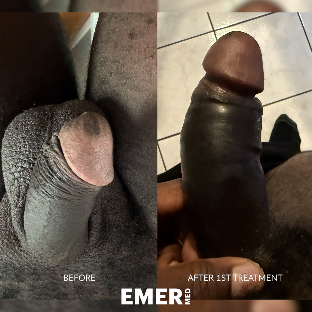 MM_BA_02