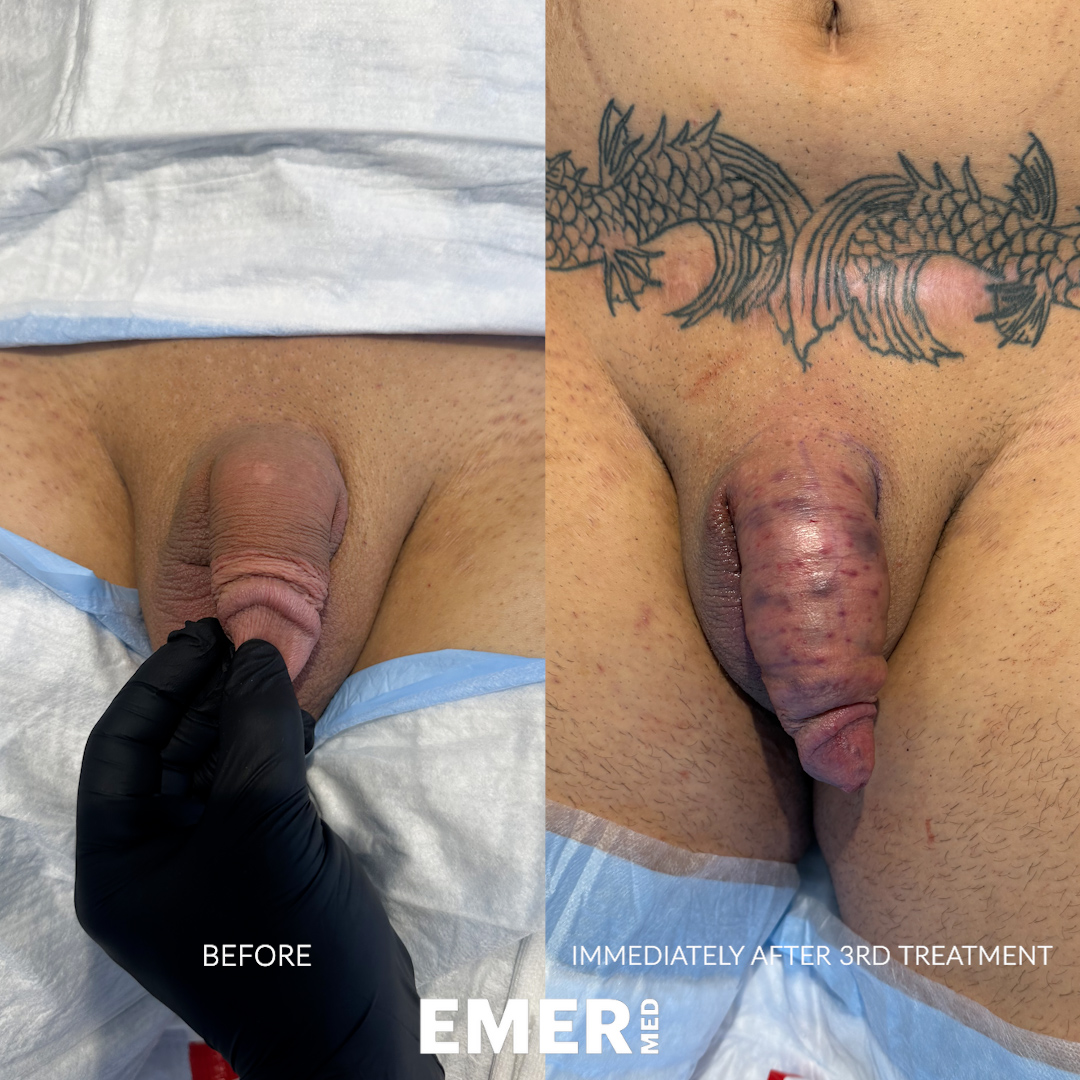 TJ_BIA_3_03