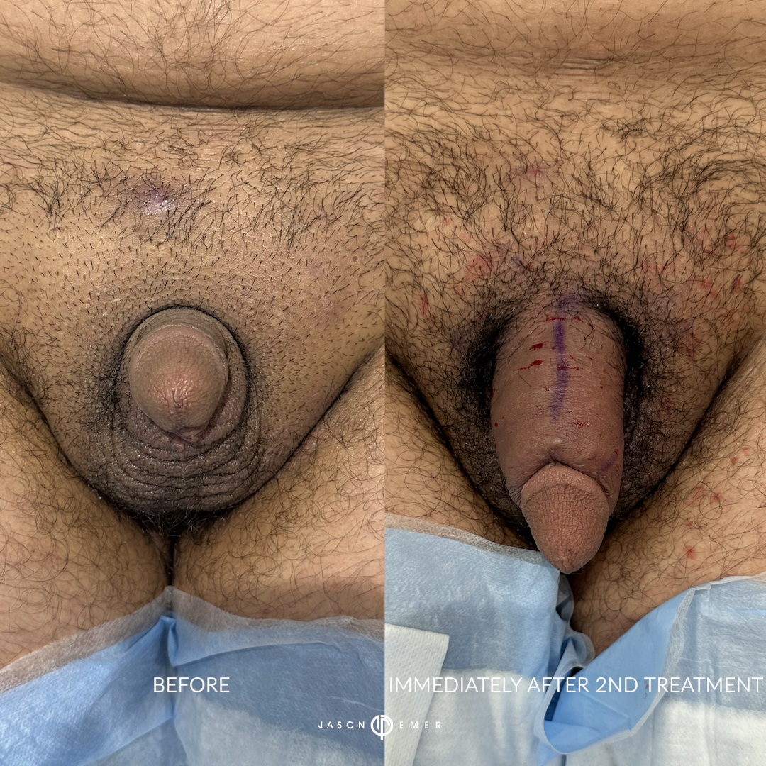 BP_2_BA_02
