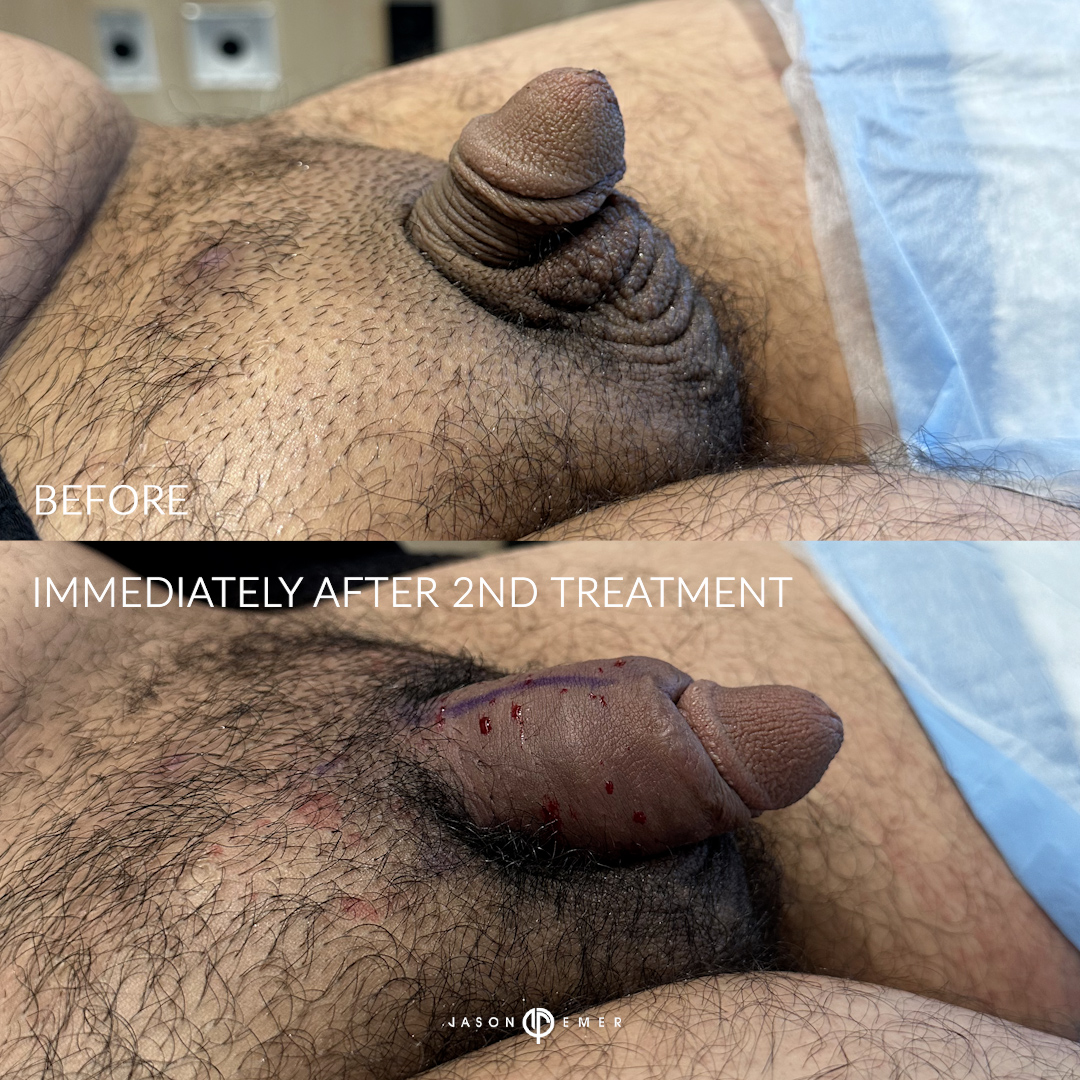 BP_2_BA_03