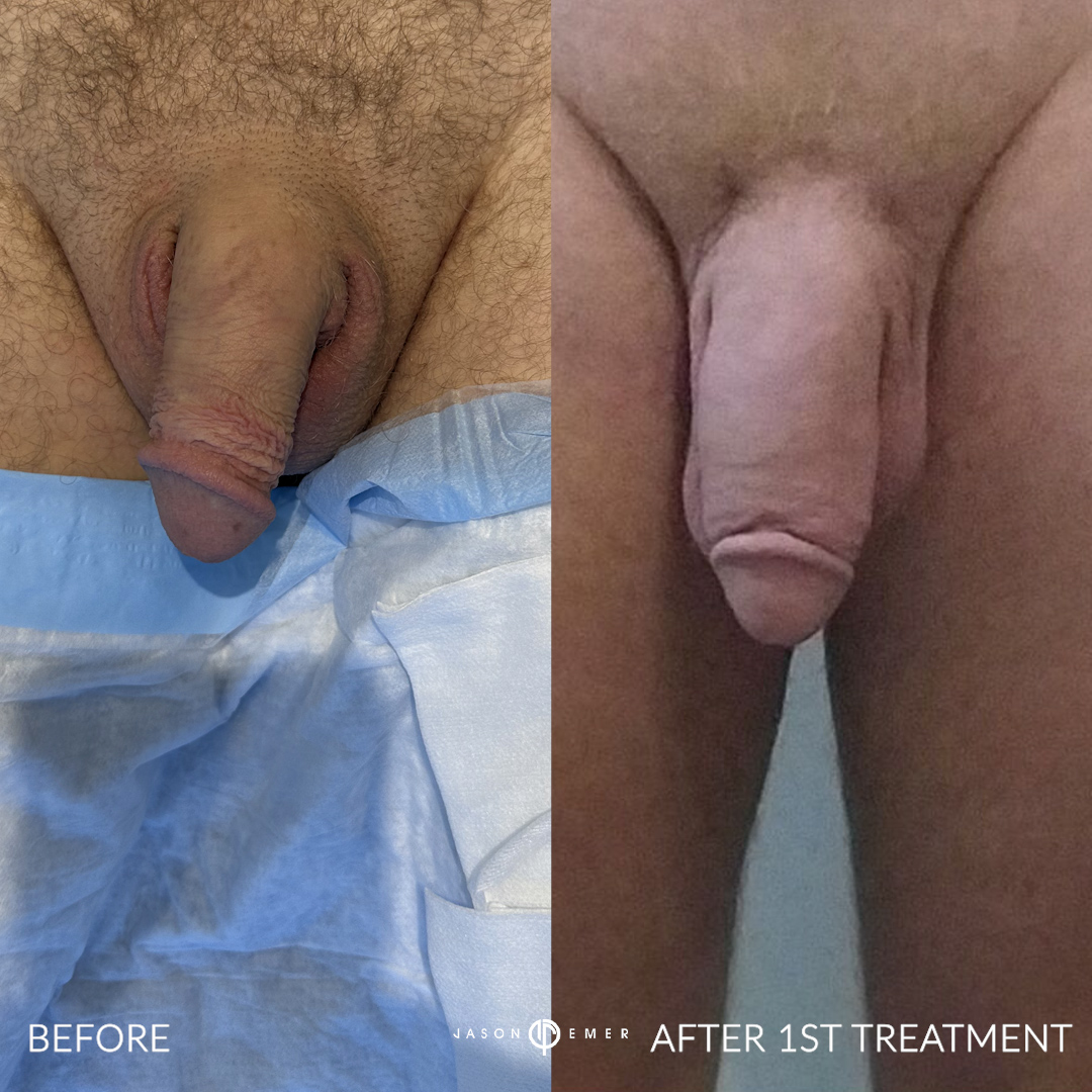 BR_S_01