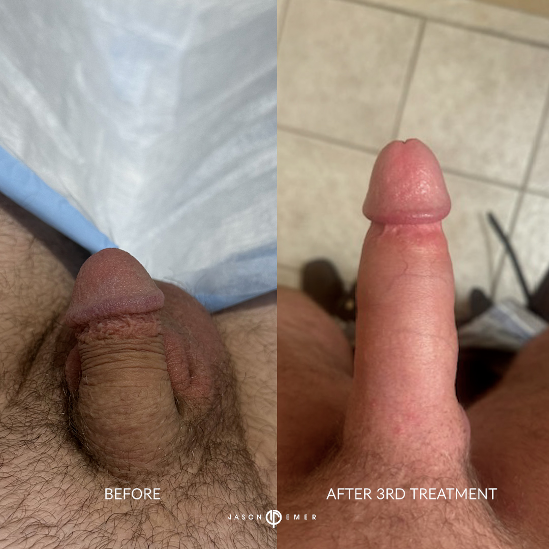JD_BA_3_01