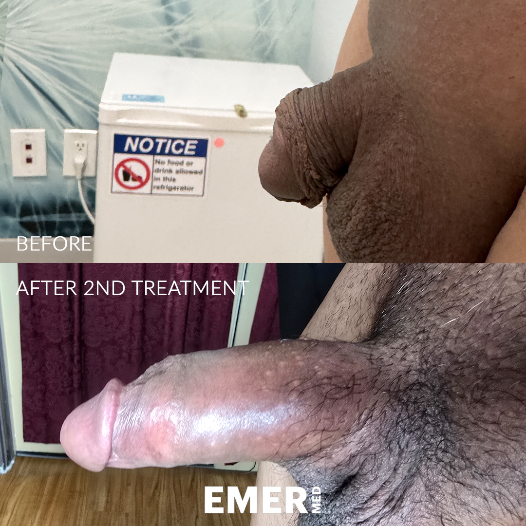 ME_BA_2_08