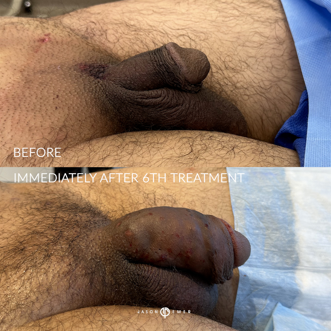 PT_6_02