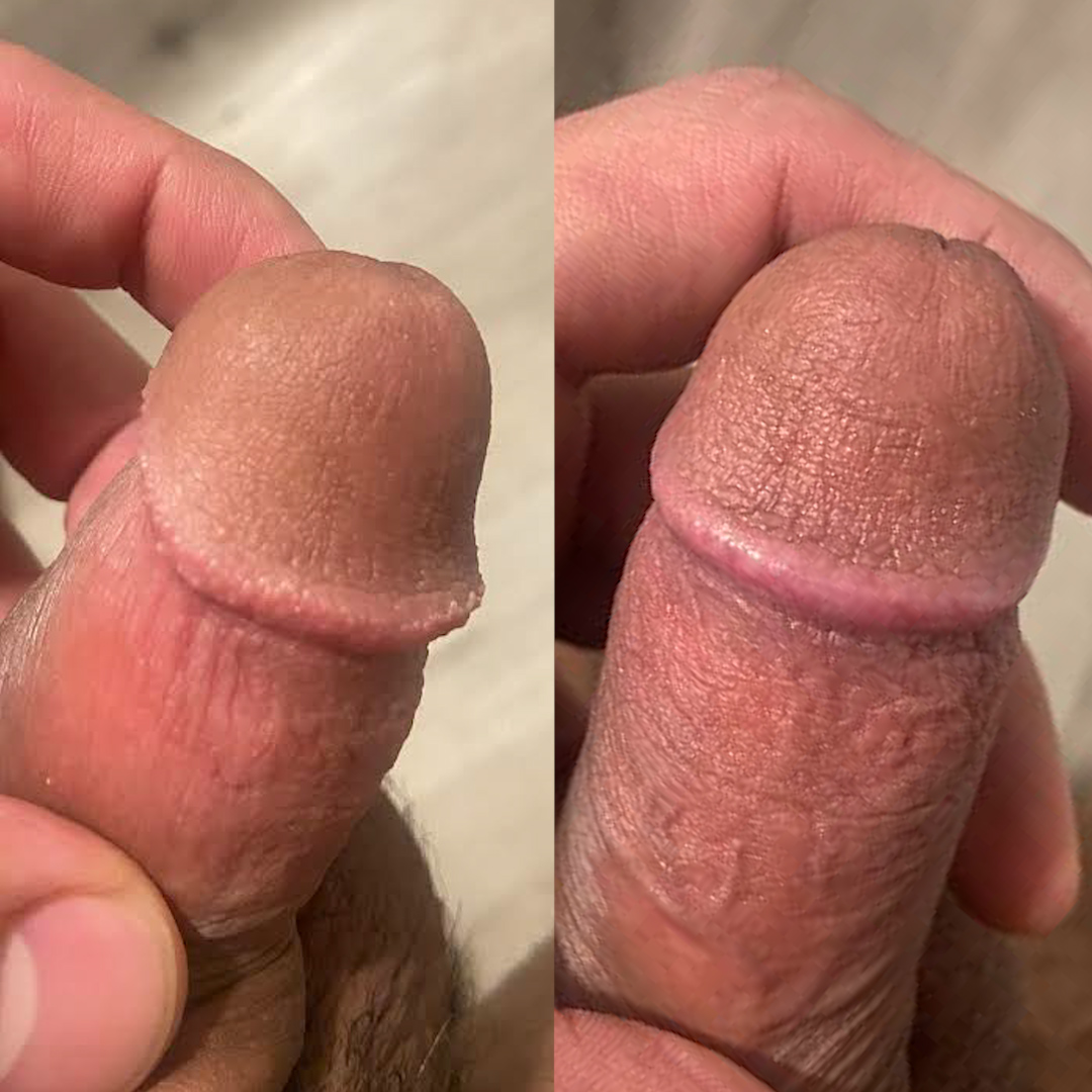 RV_03