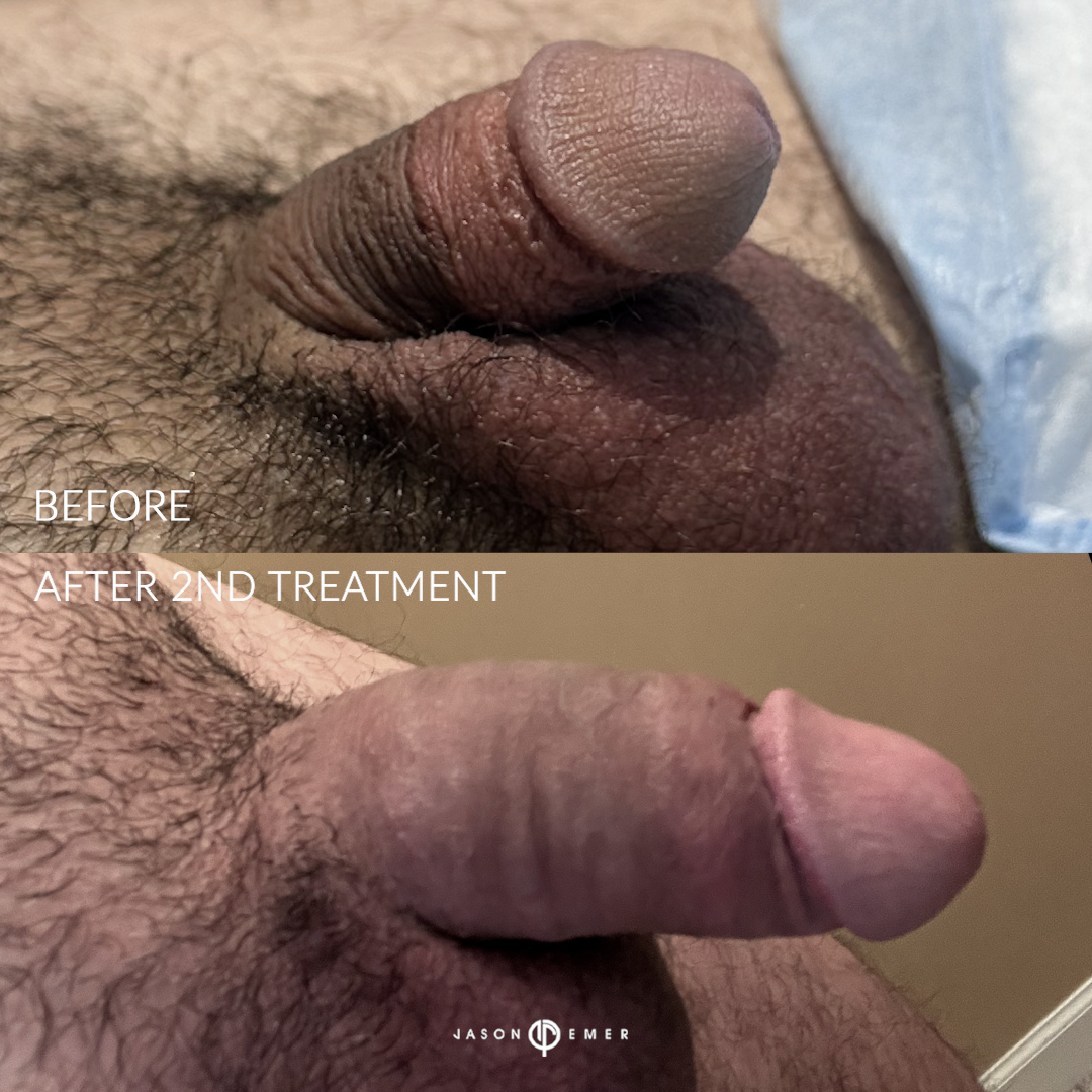 T_J_03